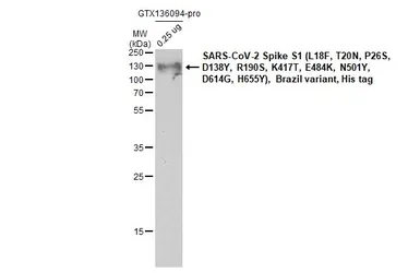 Anti-SARS-CoV-2 (COVID-19) Spike RBD antibody [HL257] used in Western Blot (WB). GTX635692