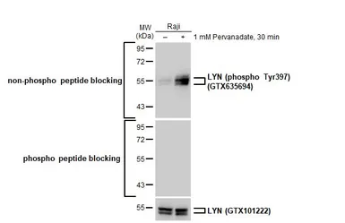 Anti-LYN (phospho Tyr397) antibody [HL122] used in Western Blot (WB). GTX635694