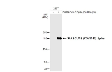 Anti-SARS-CoV-2 (COVID-19) Spike S1 antibody [GT263] used in Western Blot (WB). GTX635708