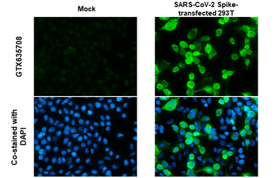 Anti-SARS-CoV-2 (COVID-19) Spike S1 antibody [GT263] used in Immunocytochemistry/ Immunofluorescence (ICC/IF). GTX635708