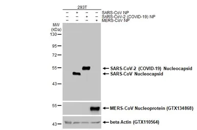 Anti-SARS-CoV-2 (COVID-19) Nucleocapsid antibody [HL455-MS] used in Western Blot (WB). GTX635712