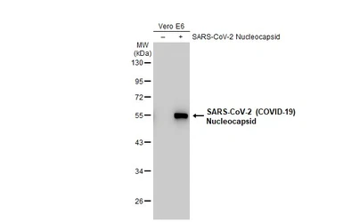 Anti-SARS-CoV-2 (COVID-19) Nucleocapsid antibody [HL455-MS] used in Western Blot (WB). GTX635712