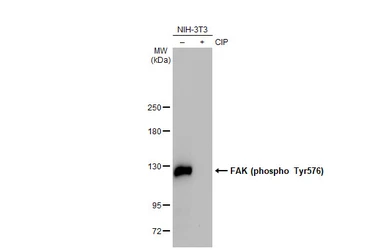 Anti-FAK (phospho Tyr576) antibody [HL127] used in Western Blot (WB). GTX635714