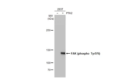 Anti-FAK (phospho Tyr576) antibody [HL127] used in Western Blot (WB). GTX635714