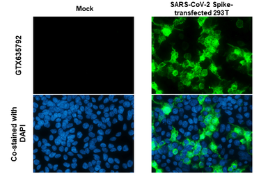 Anti-SARS-CoV-2 (COVID-19) Spike RBD antibody [HL1003] used in Immunocytochemistry/ Immunofluorescence (ICC/IF). GTX635792