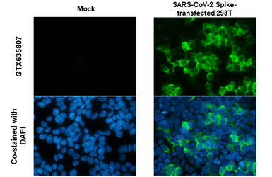 Anti-SARS-CoV-2 (COVID-19) Spike RBD antibody [HL1014] used in Immunocytochemistry/ Immunofluorescence (ICC/IF). GTX635807