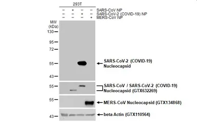 Anti-SARS-CoV-2 (COVID-19) Nucleocapsid antibody [GT113] used in Western Blot (WB). GTX635808