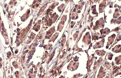 Anti-NRF2 antibody [HL1021] used in IHC (Paraffin sections) (IHC-P). GTX635826