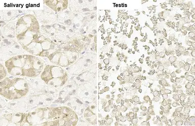 Anti-NRF2 antibody [HL1021] used in IHC (Paraffin sections) (IHC-P). GTX635826