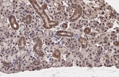 Anti-NRF2 antibody [HL1021] used in IHC (Paraffin sections) (IHC-P). GTX635826