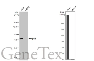 Anti-p63 antibody [HL1027] used in Western Blot (WB). GTX635841