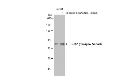 Anti-GRK2 (phospho Ser670) antibody [HL1035] used in Western Blot (WB). GTX635875