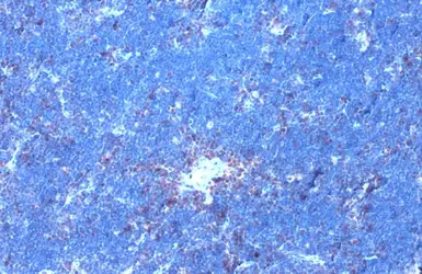 Anti-GRK2 (phospho Ser670) antibody [HL1035] used in IHC (Paraffin sections) (IHC-P). GTX635875