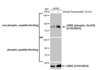 Anti-GRK2 (phospho Ser670) antibody [HL1035] used in Western Blot (WB). GTX635875