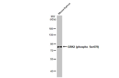 Anti-GRK2 (phospho Ser670) antibody [HL1035] used in Western Blot (WB). GTX635875