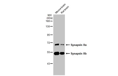 Anti-Synapsin II antibody [GT387] used in Western Blot (WB). GTX635883