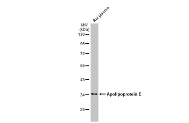 Anti-Apolipoprotein E antibody [GT27711] used in Western Blot (WB). GTX635889