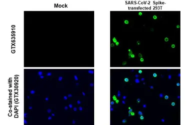 Anti-SARS-CoV-2 (COVID-19) Spike S2 antibody [HL1038] used in IHC-P (cell pellet) (IHC-P (cell pellet)). GTX635910