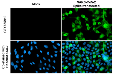 Anti-SARS-CoV-2 (COVID-19) Spike S2 antibody [HL1038] used in Immunocytochemistry/ Immunofluorescence (ICC/IF). GTX635910
