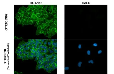 Anti-EpCAM antibody [GT25512] used in Immunocytochemistry/ Immunofluorescence (ICC/IF). GTX635967