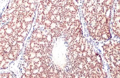 Anti-Androgen Receptor antibody [HL1049] used in IHC (Paraffin sections) (IHC-P). GTX636021