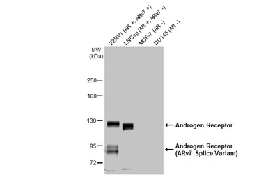 Anti-Androgen Receptor antibody [HL1049] used in Western Blot (WB). GTX636021