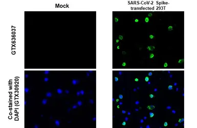 Anti-SARS-CoV-2 (COVID-19) Spike S2 antibody [GT745] used in IHC-P (cell pellet) (IHC-P (cell pellet)). GTX636037