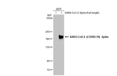 Anti-SARS-CoV-2 (COVID-19) Spike S2 antibody [GT8110] used in Western Blot (WB). GTX636038