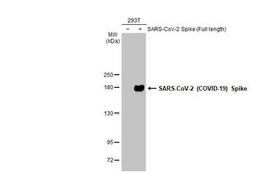 Anti-SARS-CoV-2 (COVID-19) Spike RBD antibody [GT5449] used in Western Blot (WB). GTX636042