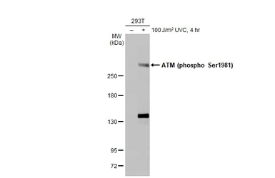 Anti-ATM (phospho Ser1981) antibody [HL1062] used in Western Blot (WB). GTX636086