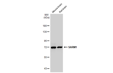 Anti-SARM1 antibody [HL1066] used in Western Blot (WB). GTX636097
