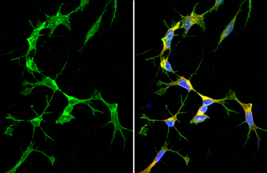 Anti-SARM1 antibody [HL1066] used in Immunocytochemistry/ Immunofluorescence (ICC/IF). GTX636097