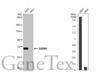 Anti-SARM1 antibody [HL1066] used in Western Blot (WB). GTX636097