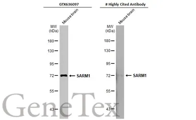 Anti-SARM1 antibody [HL1066] used in Western Blot (WB). GTX636097