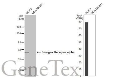 Anti-Estrogen Receptor alpha antibody [HL1081] used in Western Blot (WB). GTX636202