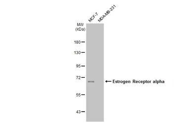 Anti-Estrogen Receptor alpha antibody [HL1082] used in Western Blot (WB). GTX636203