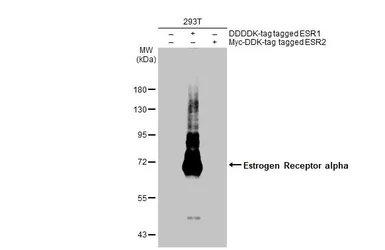 Anti-Estrogen Receptor alpha antibody [HL1082] used in Western Blot (WB). GTX636203