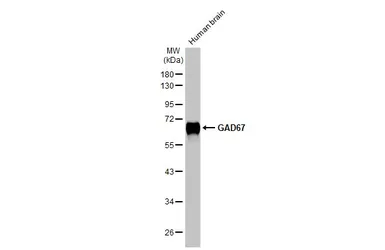 Anti-GAD67 antibody [HL1096] used in Western Blot (WB). GTX636280