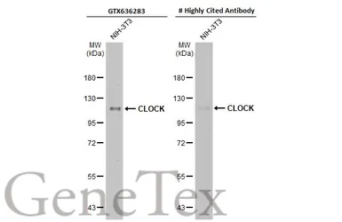 Anti-CLOCK antibody [HL1099] used in Western Blot (WB). GTX636283