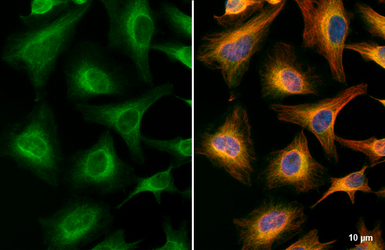 Anti-AChE antibody [HL1102] used in Immunocytochemistry/ Immunofluorescence (ICC/IF). GTX636298