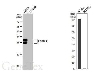 Anti-RBPMS antibody [HL1106] used in Western Blot (WB). GTX636321