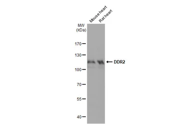Anti-DDR2 antibody [HL1107] used in Western Blot (WB). GTX636322
