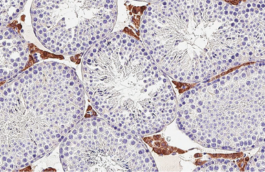 Anti-DDR2 antibody [HL1107] used in IHC (Paraffin sections) (IHC-P). GTX636322