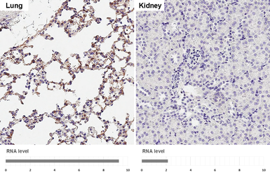 Anti-DDR2 antibody [HL1107] used in IHC (Paraffin sections) (IHC-P). GTX636322