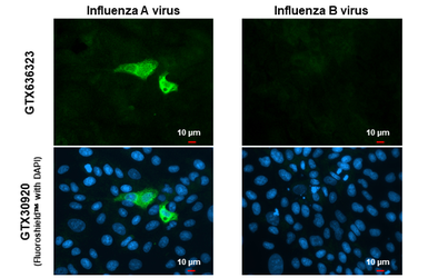 Anti-Influenza A virus H1N1 NA (Neuraminidase) antibody [HL1108] used in Immunocytochemistry/ Immunofluorescence (ICC/IF). GTX636323