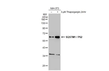 Anti-SQSTM1 / P62 antibody [HL1113] used in Western Blot (WB). GTX636328