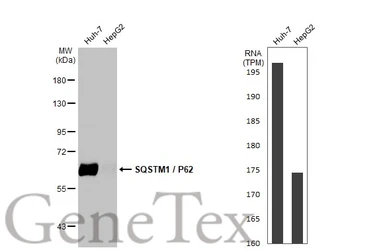 Anti-SQSTM1 / P62 antibody [HL1113] used in Western Blot (WB). GTX636328