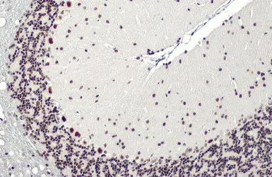 Anti-SMARCA2 antibody [HL1115] used in IHC (Paraffin sections) (IHC-P). GTX636330