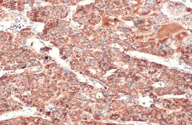 Anti-SDHA antibody [HL1117] used in IHC (Paraffin sections) (IHC-P). GTX636335