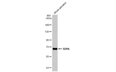 Anti-SDHA antibody [HL1117] used in Western Blot (WB). GTX636335